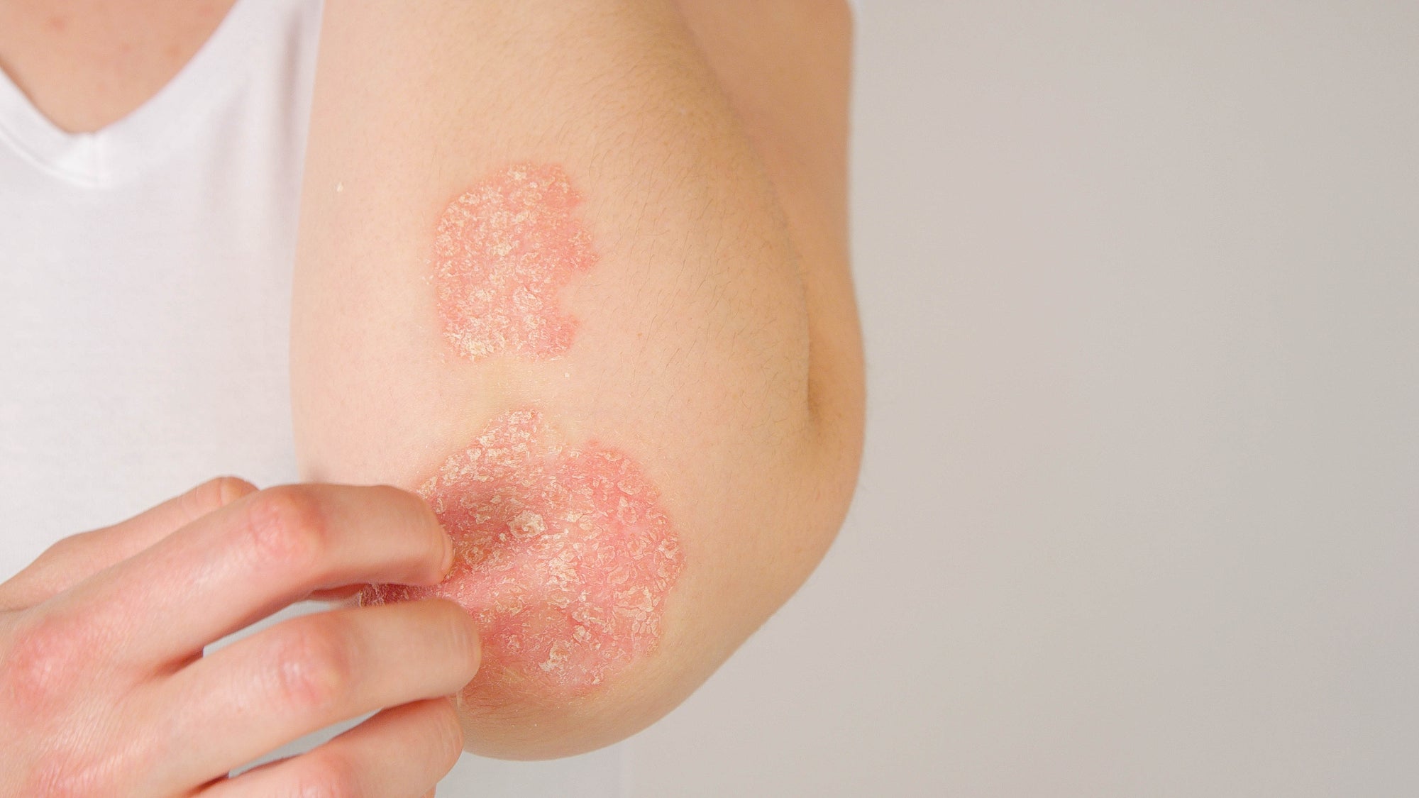 THE 5 BEST INGREDIENTS TO GET YOUR DRY SKIN, SORTED