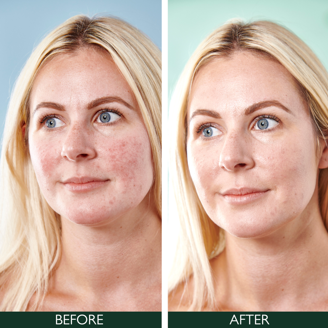 TRIAL SACHET 5 IN 1 AR DAY CREAM SPF50