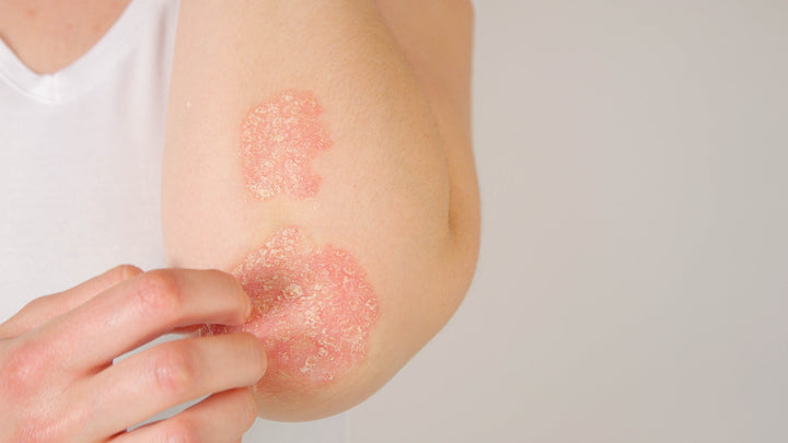 THE 5 BEST INGREDIENTS TO GET YOUR DRY SKIN, SORTED