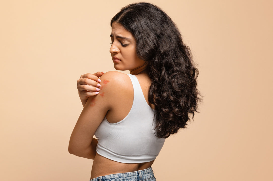 Psoriasis - Breaking the flare-up cycle