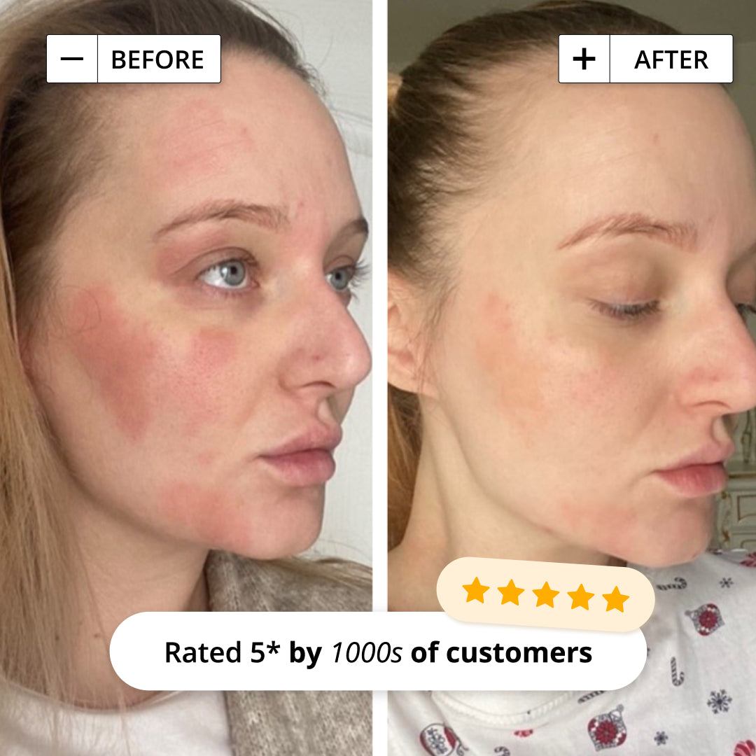 INTENSIVE RESCUE FACE LOTION