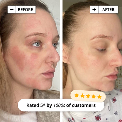 INTENSIVE RESCUE FACE LOTION