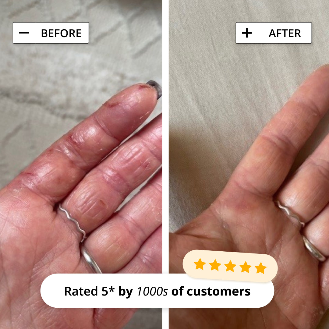 INTENSIVE RESCUE SPRAY