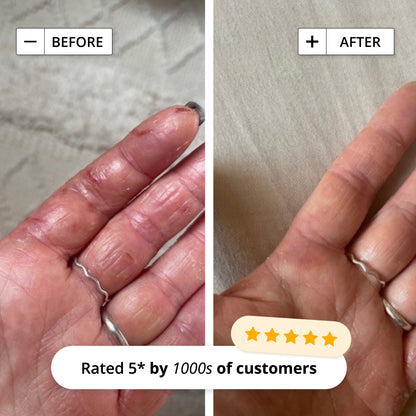 INTENSIVE RESCUE SPRAY
