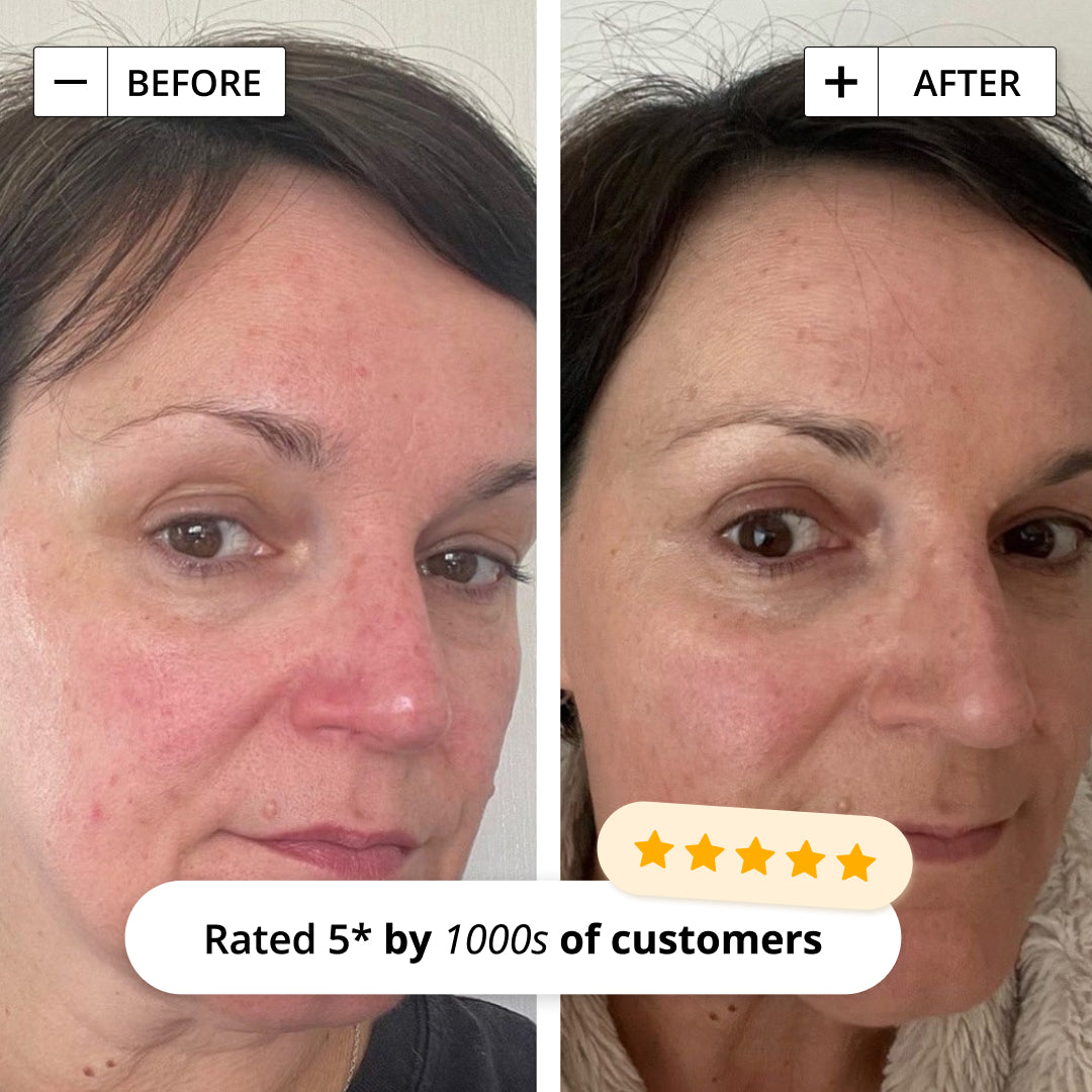3 IN 1 ANTI-REDNESS FACE SERUM