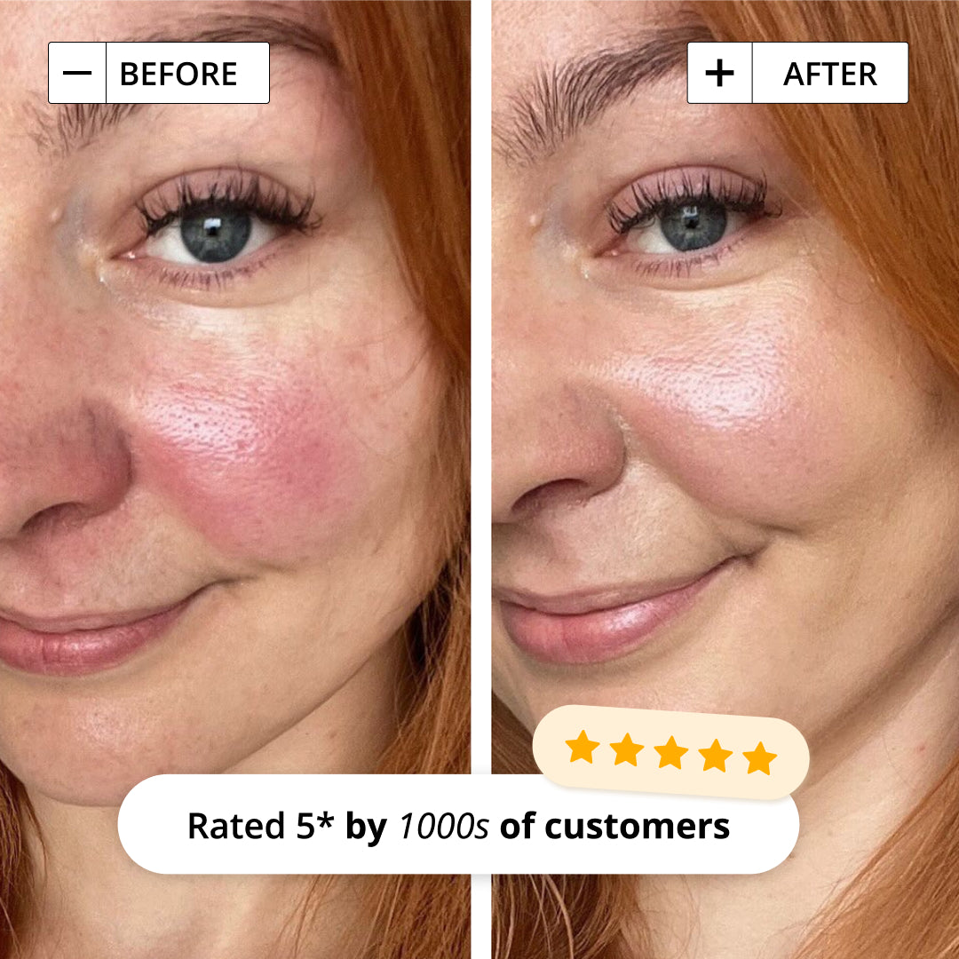 5 IN 1 ANTI-REDNESS DAY CREAM SPF50