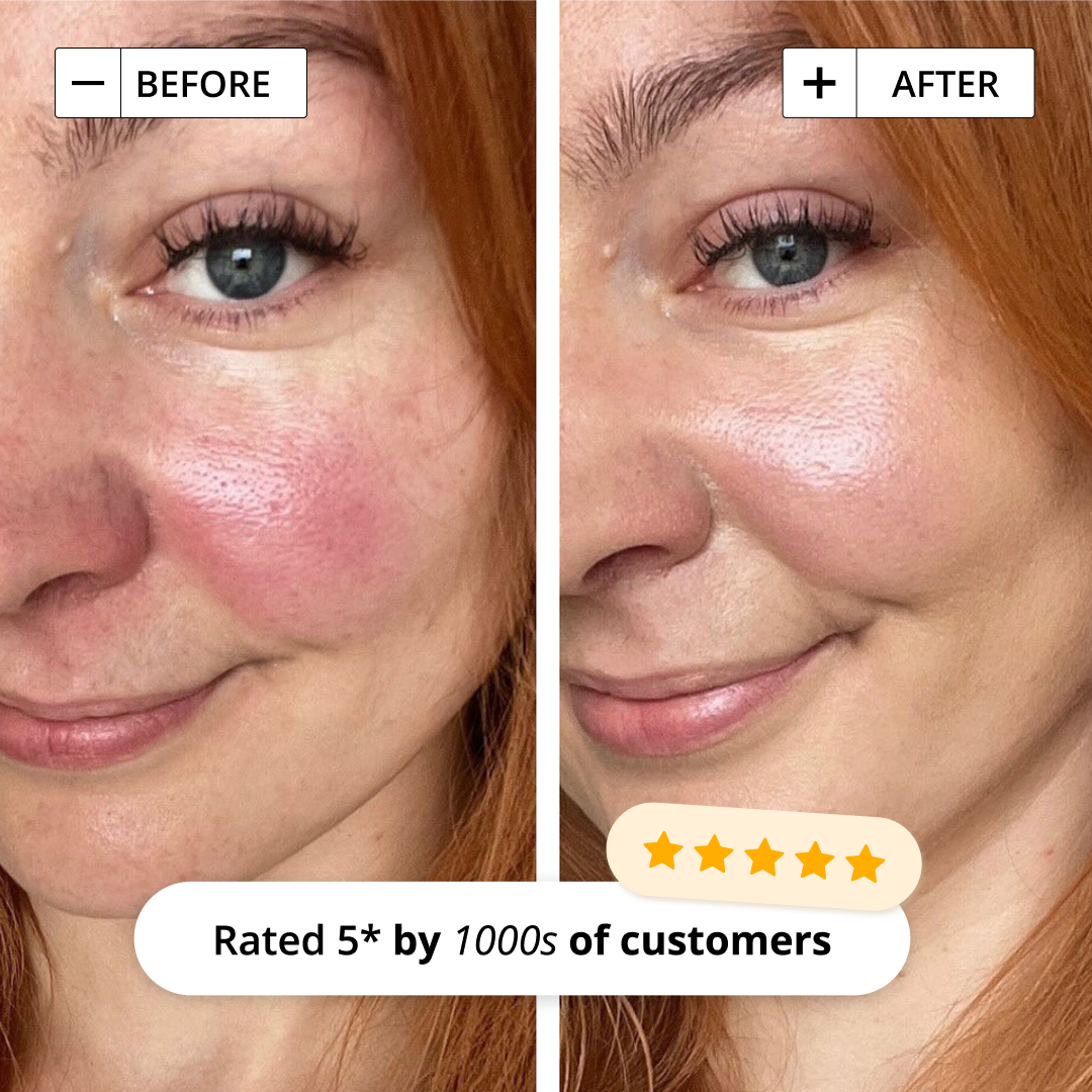 5 IN 1 ANTI-REDNESS DAY CREAM SPF50