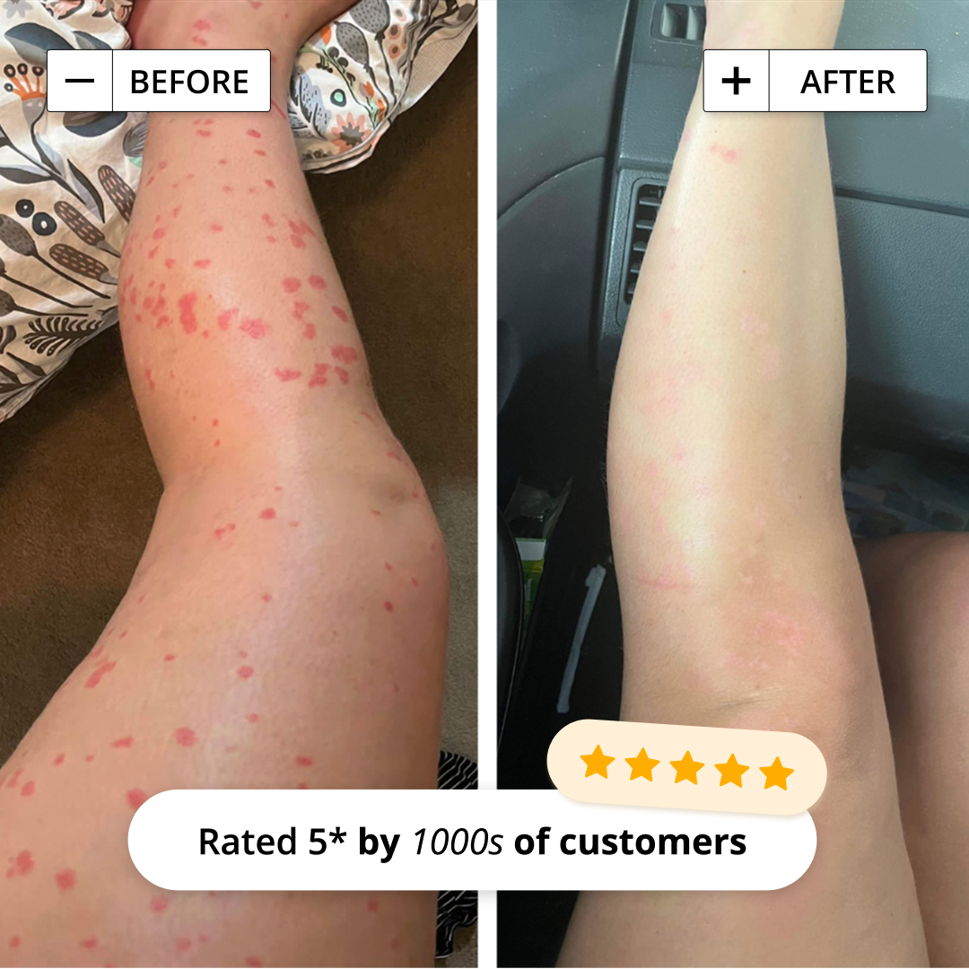 INTENSIVE RESCUE MOISTURISER